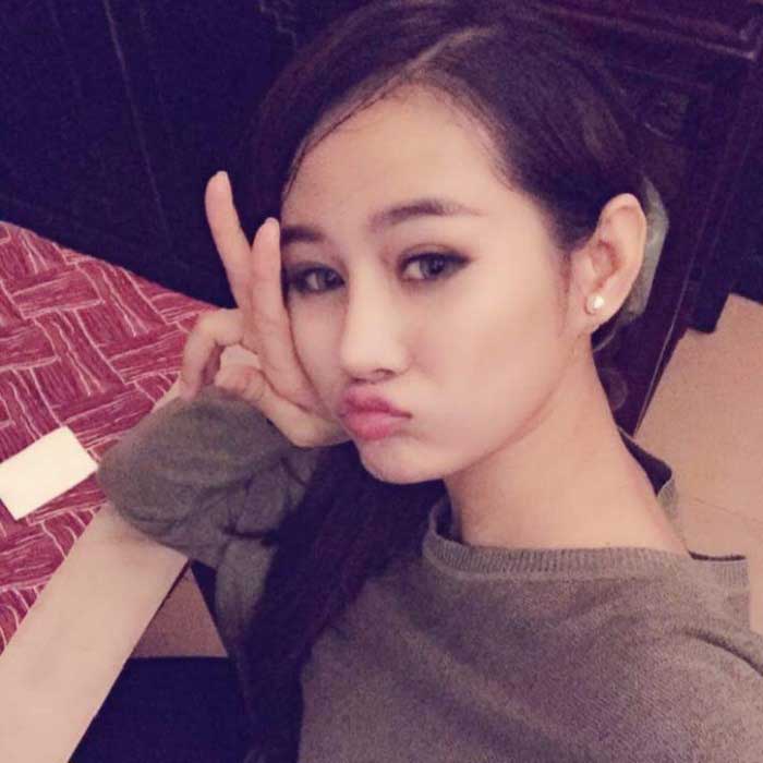 Nâng mũi Hàn Quốc