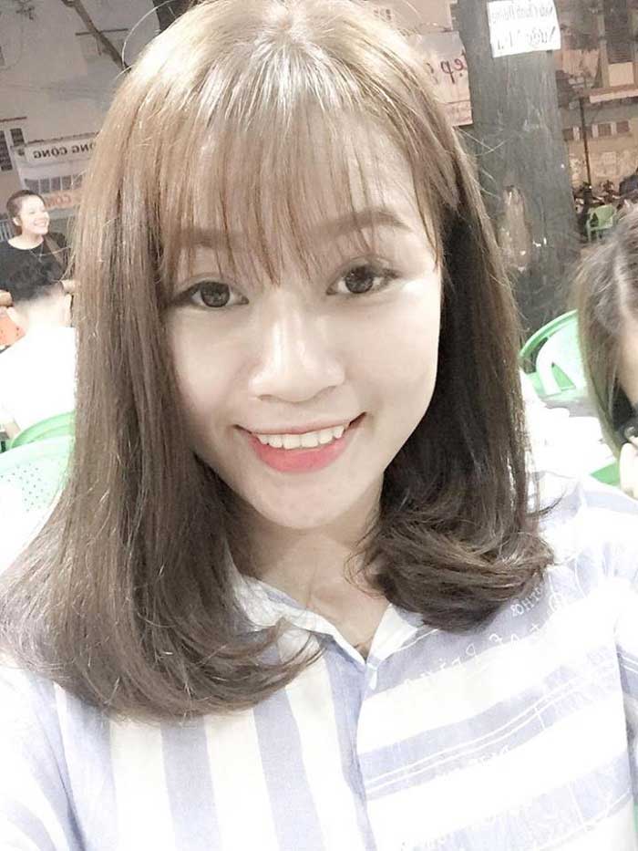 Nâng mũi bọc sụn