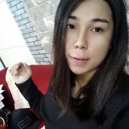 Bấm mí Hàn Quốc