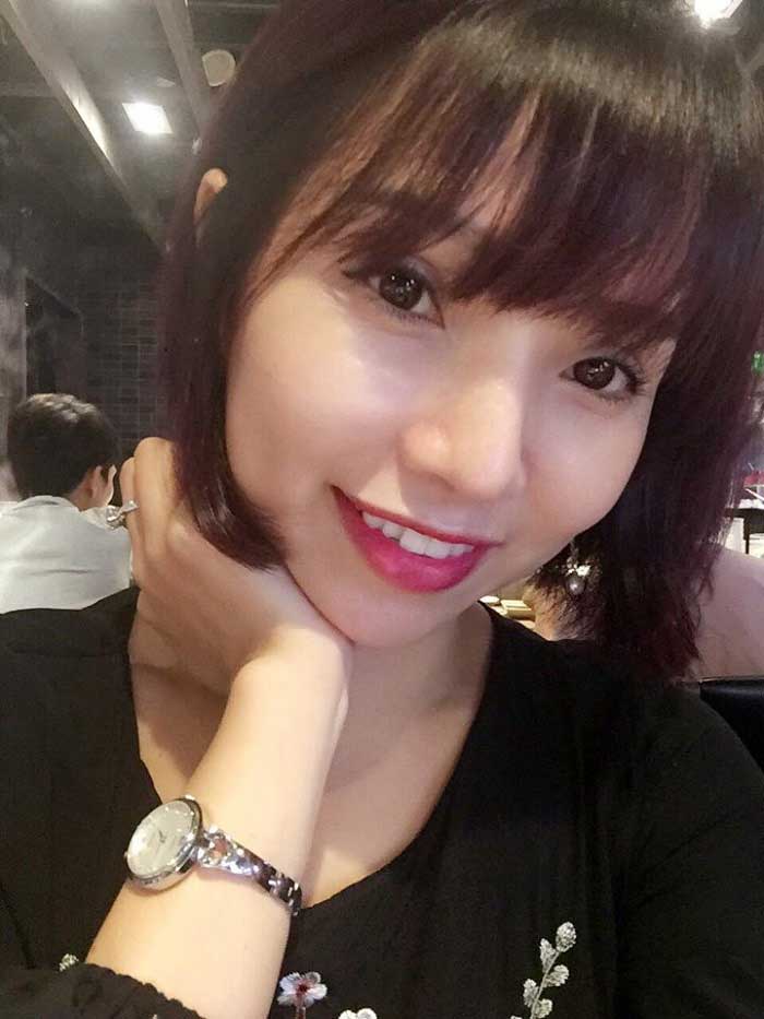 Cắt mí mắt