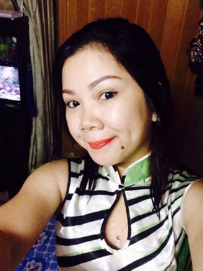 Cắt mí mắt