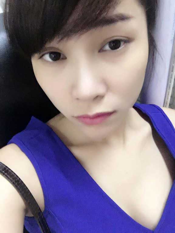 Độn cằm
