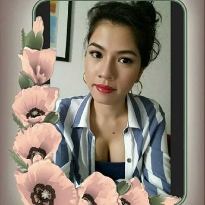 Lấy mỡ má