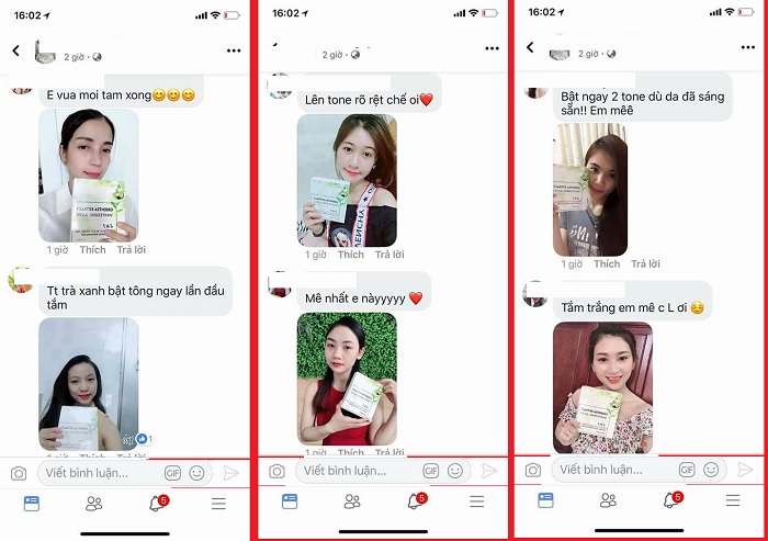 Nâng mũi bọc sụn