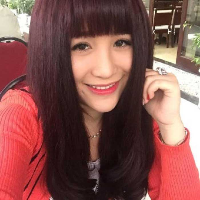 Nâng mũi bọc sụn