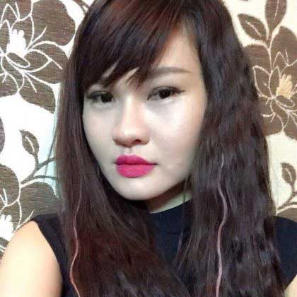 Cắt mí mắt