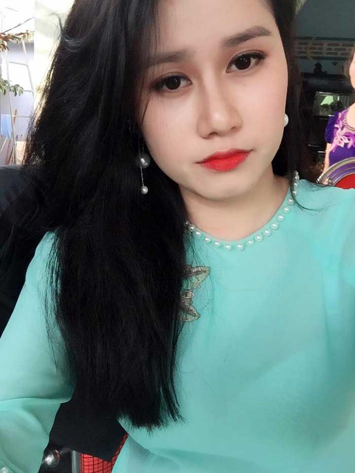 Nâng mũi S Line