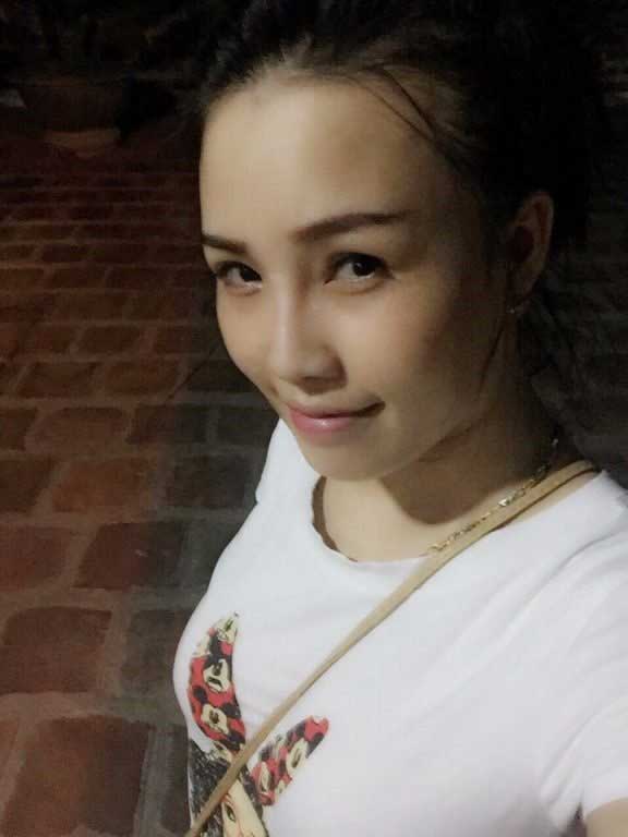 Bấm mí Hàn Quốc