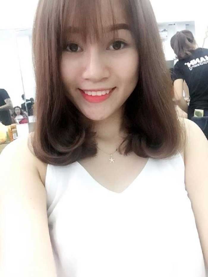 Nâng mũi bọc sụn