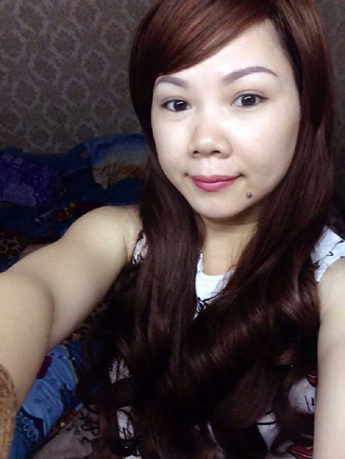 Cắt mí mắt