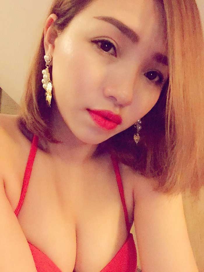Cắt mí mắt