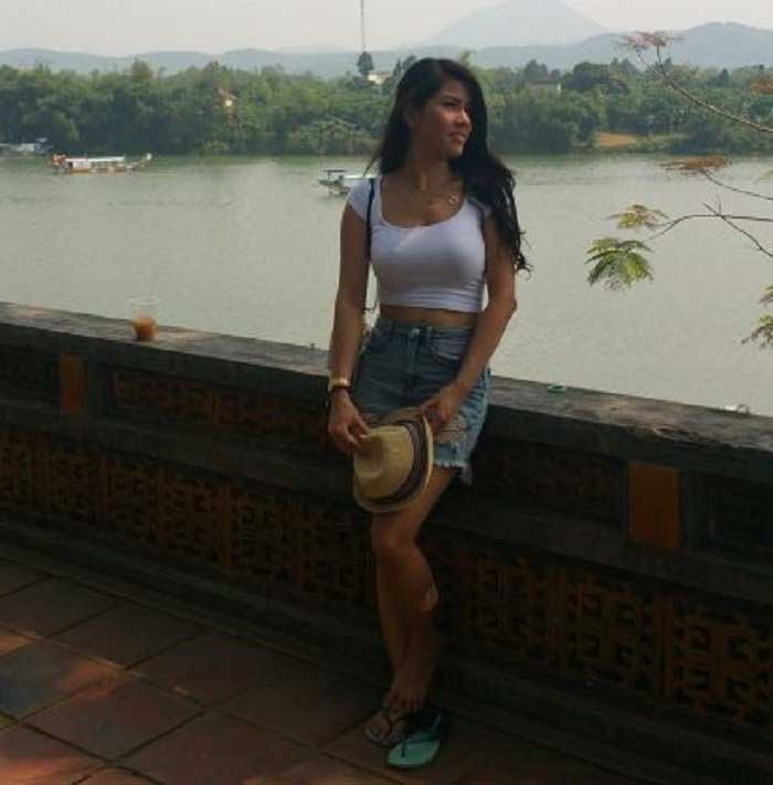 Lấy mỡ má