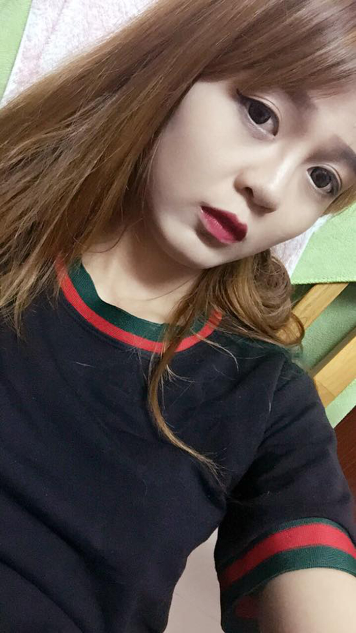 Nâng mũi bọc sụn