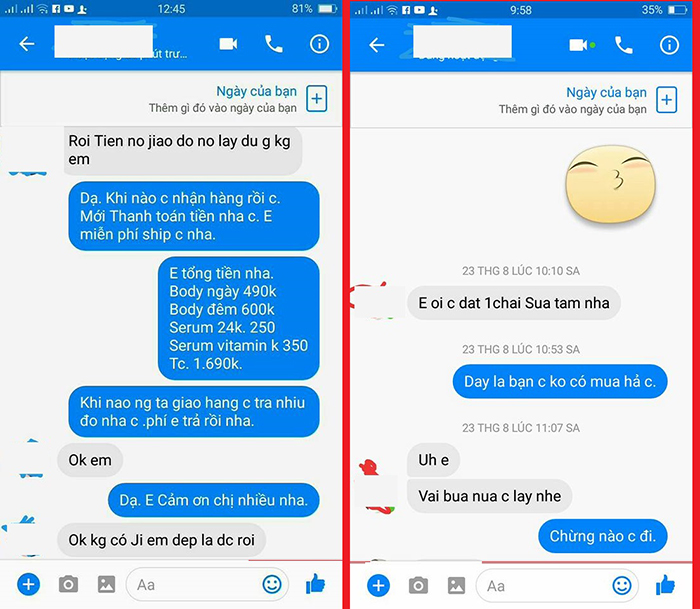 Nâng mũi bọc sụn