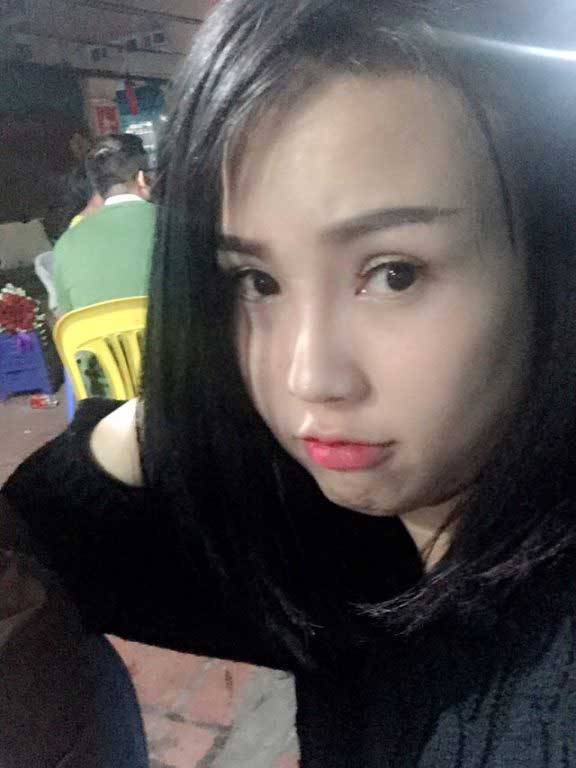 Bấm mí Hàn Quốc