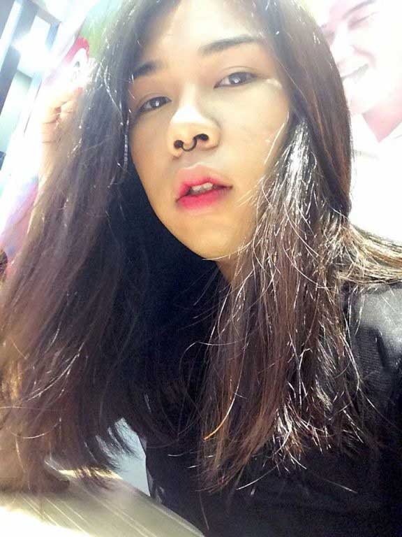Bấm mí Hàn Quốc