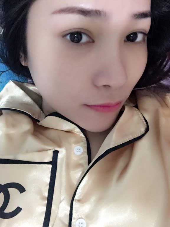 Độn cằm