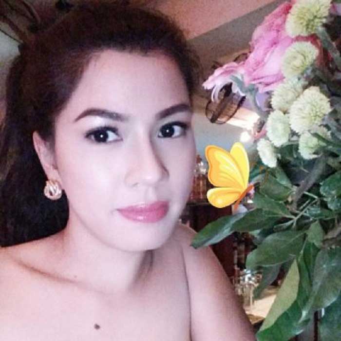 Lấy mỡ má