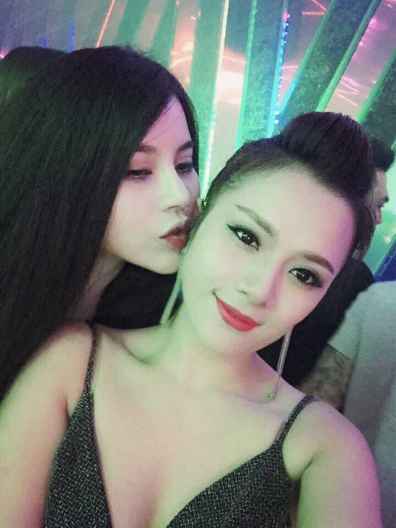 Nâng mũi S Line