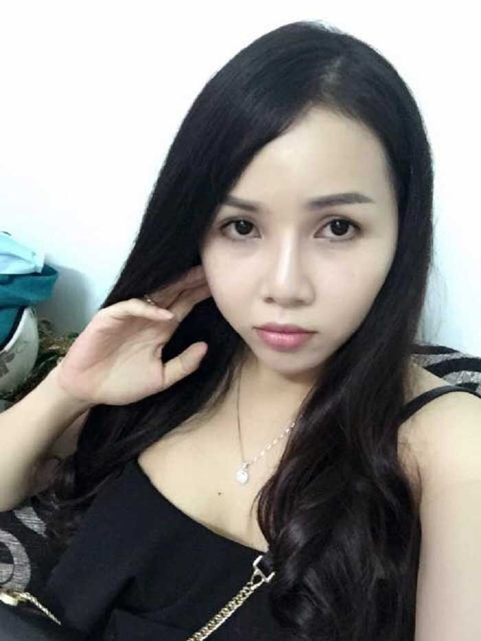 Nâng mũi Hàn Quốc