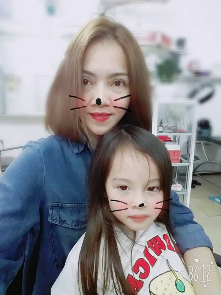 Cắt mí mắt