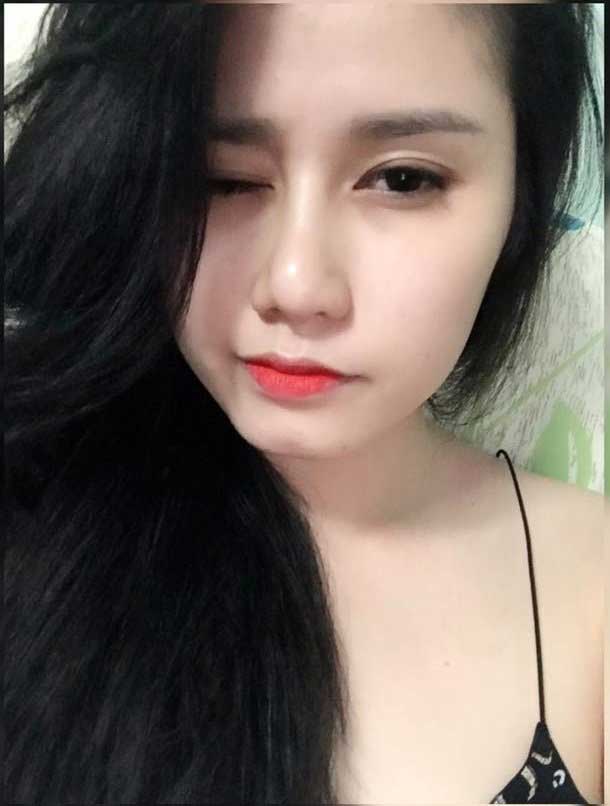 Nâng mũi S Line