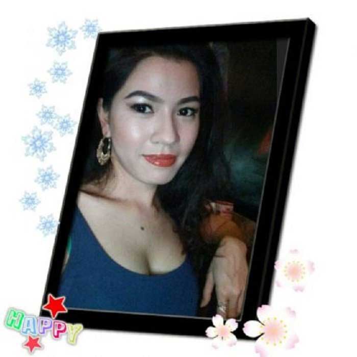 Lấy mỡ má