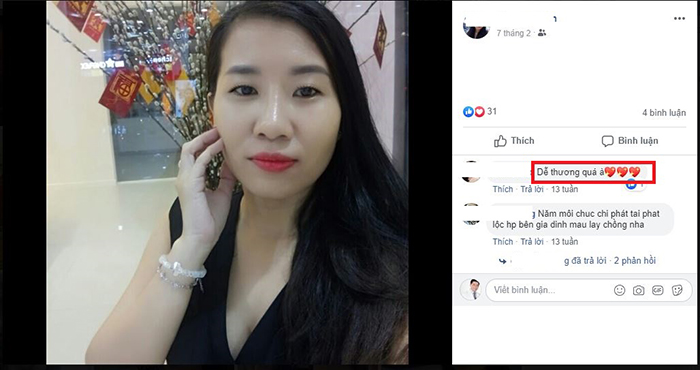 Nâng mũi Hàn Quốc