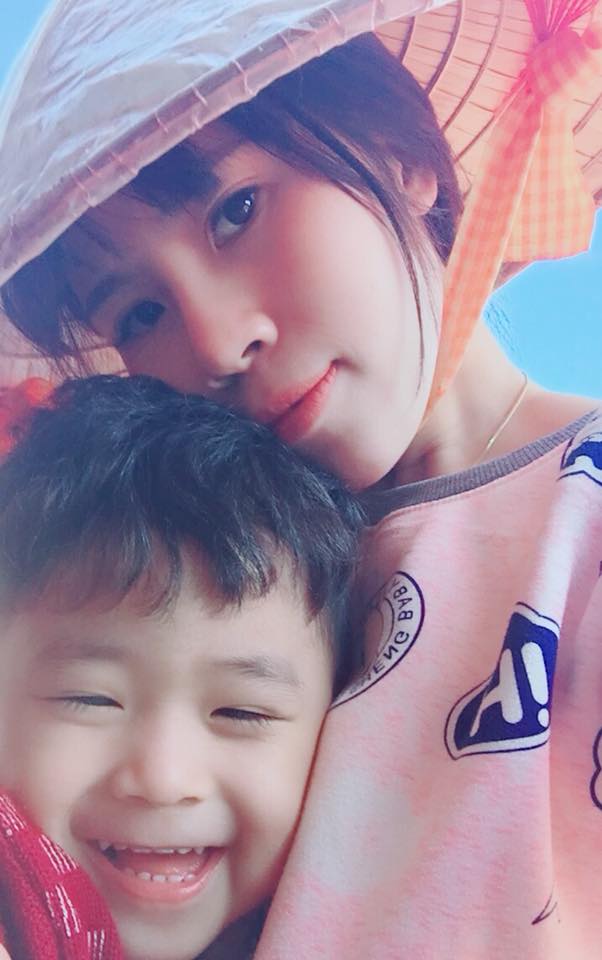 Nâng mũi bọc sụn