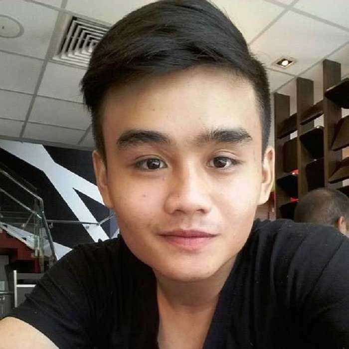 Nâng mũi bọc sụn