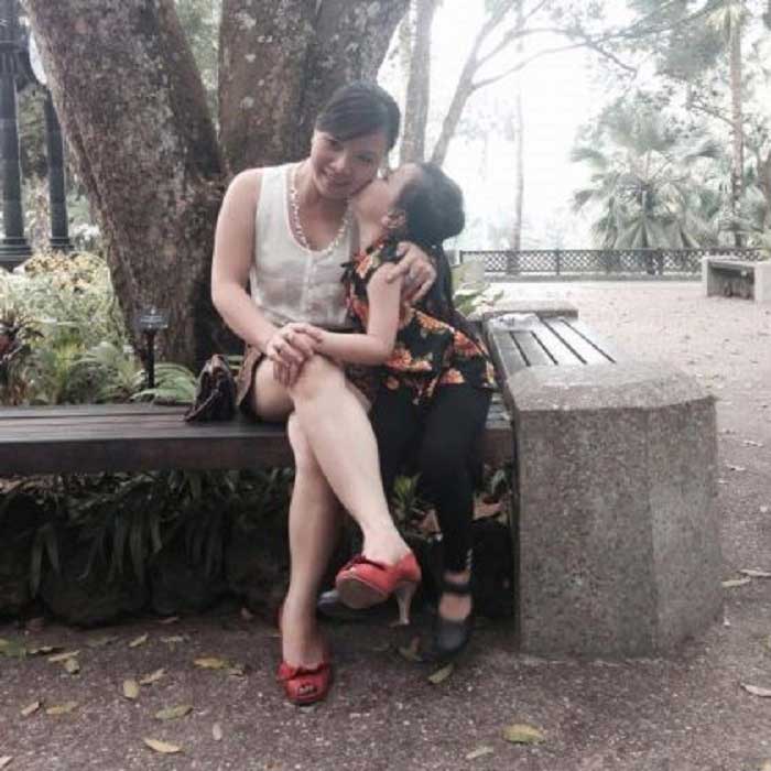 Nâng mũi bọc sụn