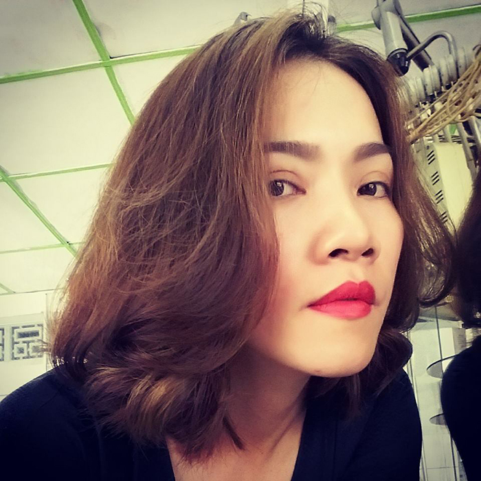 Cắt mí mắt