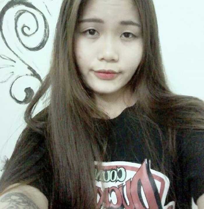 Nâng mũi bọc sụn