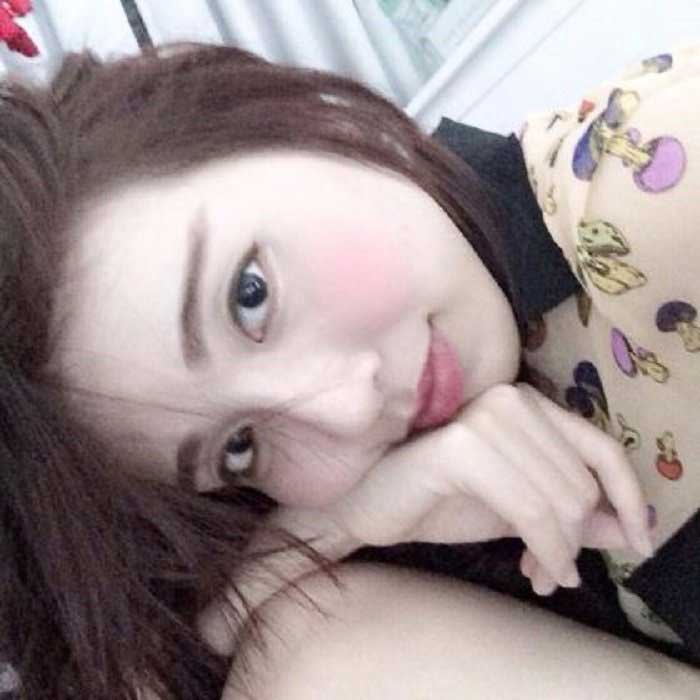 Nâng mũi Hàn Quốc