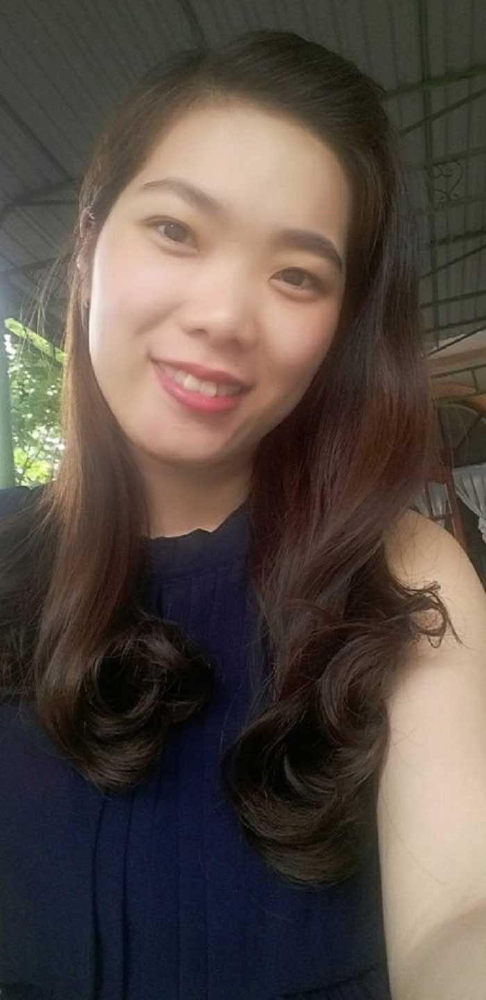 Nâng mũi bọc sụn