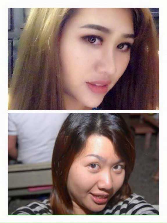 Độn cằm