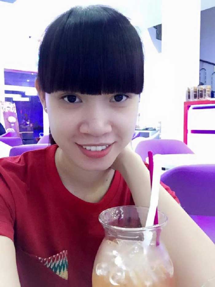 Nâng mũi bọc sụn