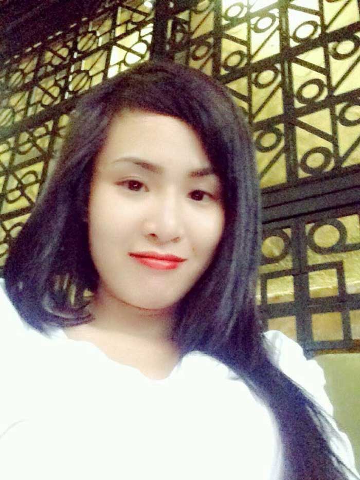 Nâng mũi Hàn Quốc