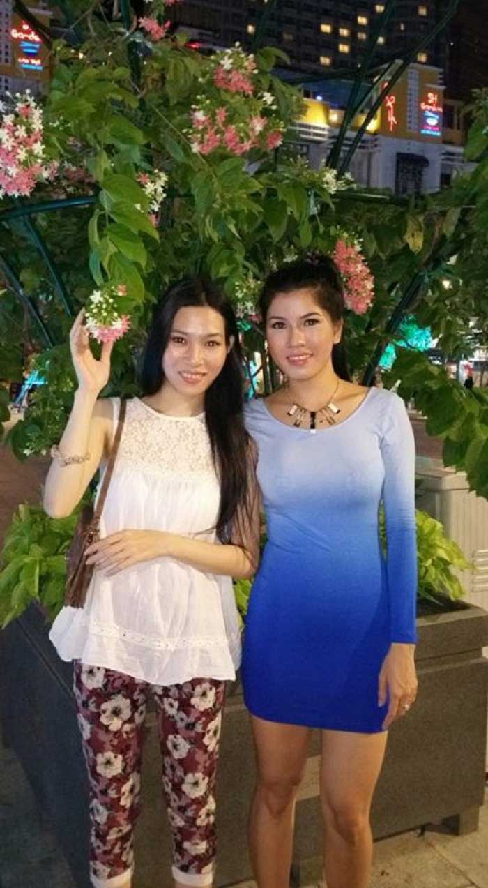 Lấy mỡ má
