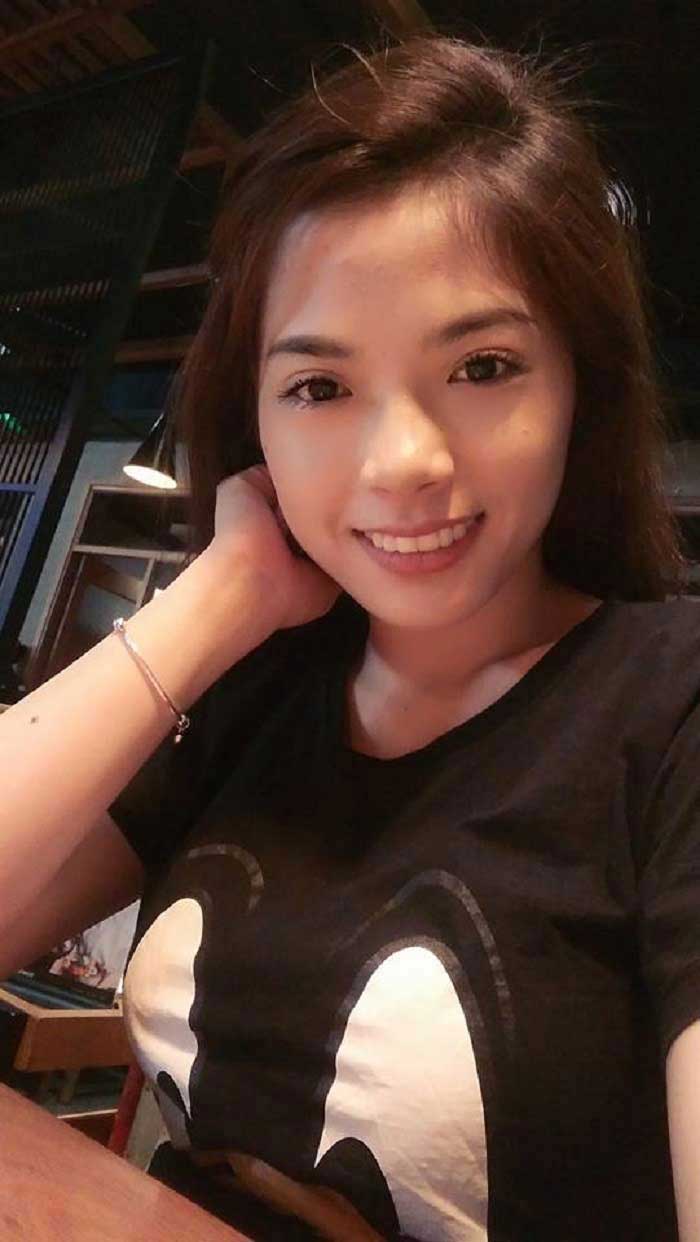 Nâng mũi bọc sụn