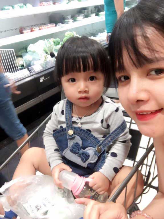 Nâng mũi S Line