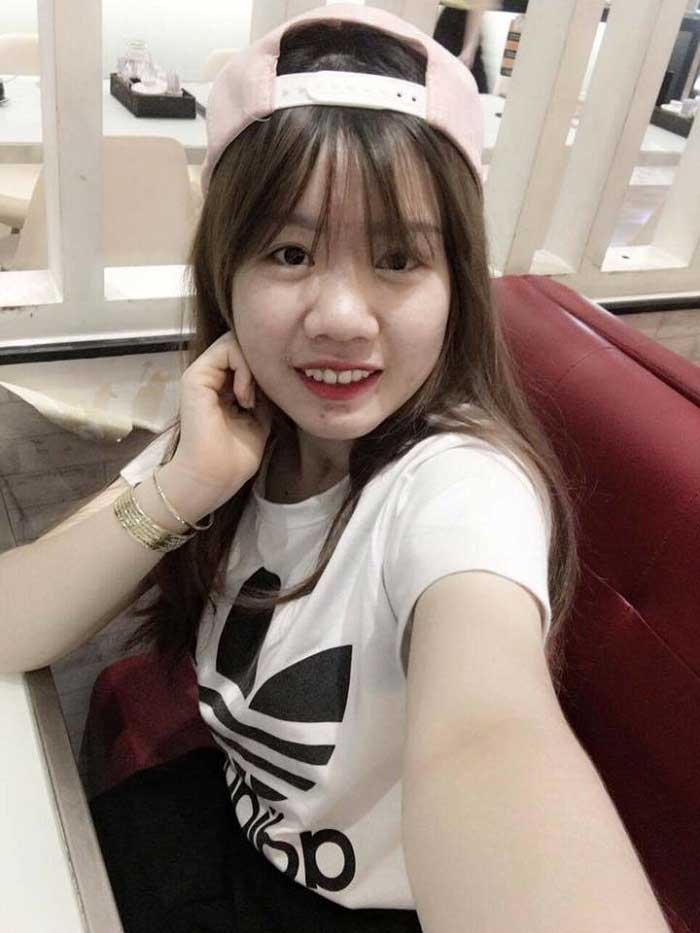 Thu gọn cánh mũi