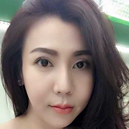 Nâng mũi S Line Nâng mũi S Line