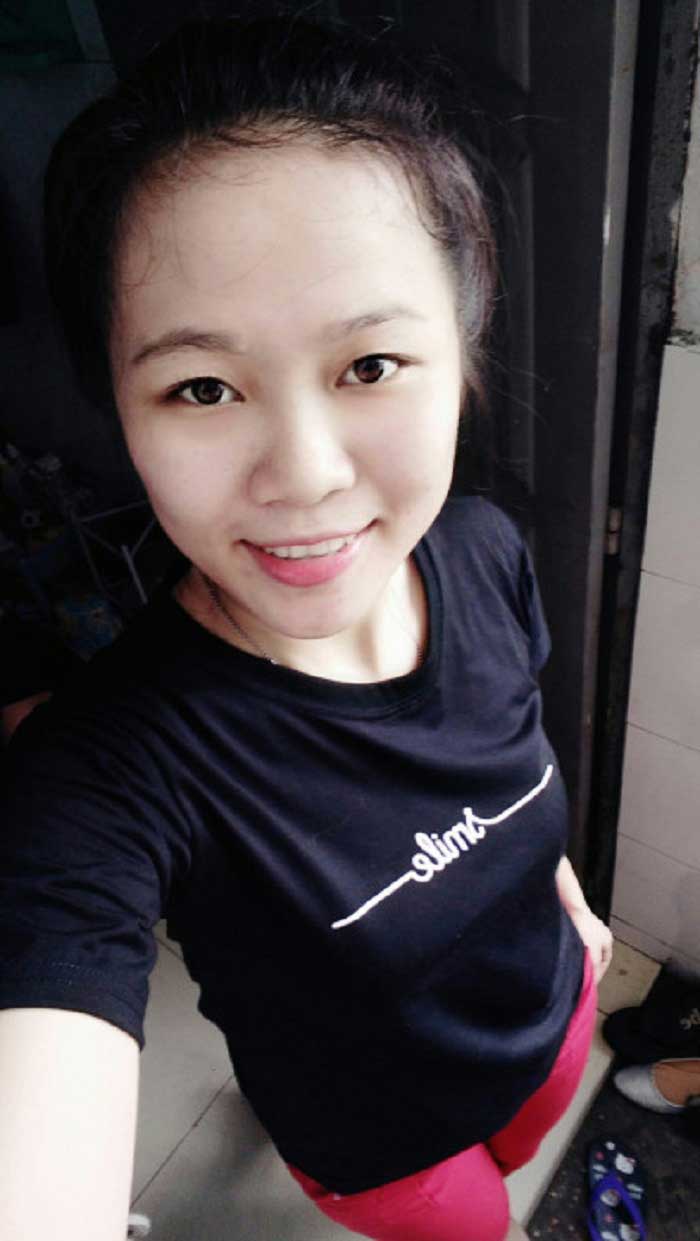 Nâng mũi bọc sụn