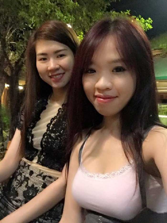 Nâng mũi bọc sụn