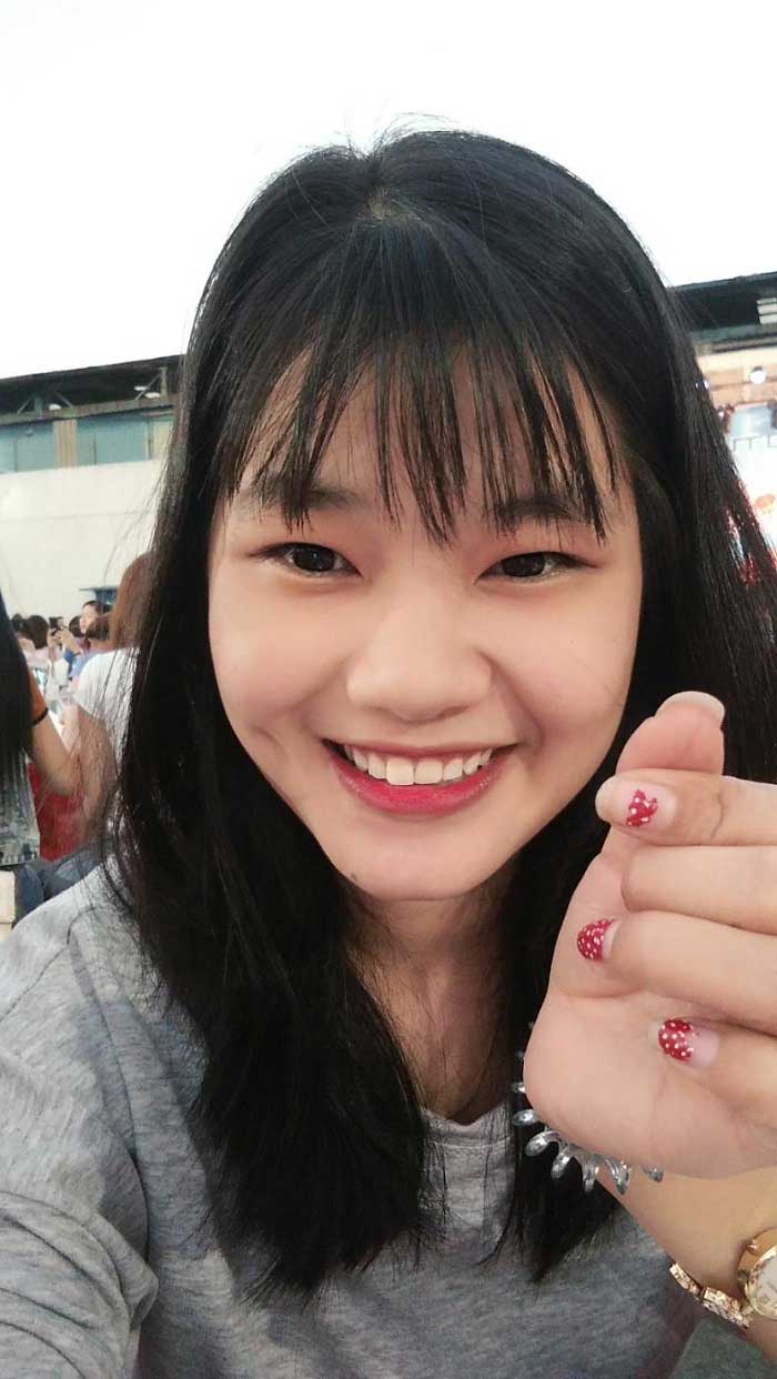 Cắt mí mắt