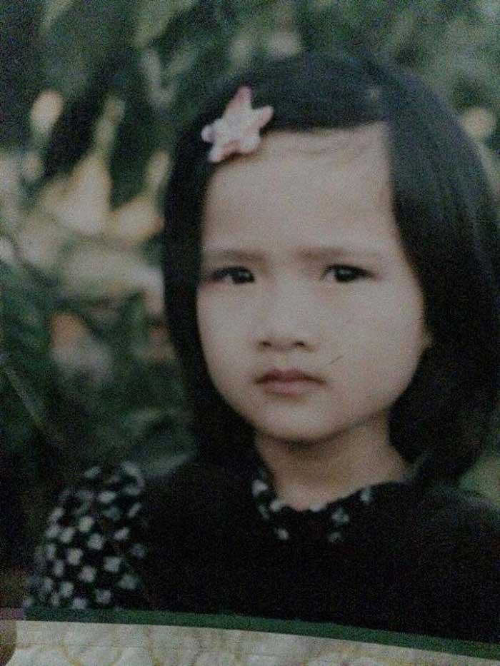 Bấm mí Hàn Quốc