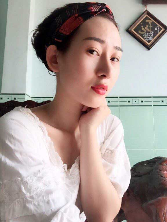 Nâng mũi S Line 