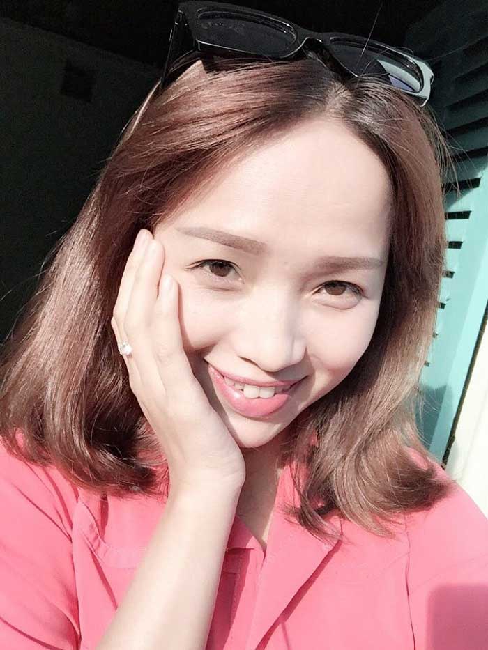 Cắt mí mắt