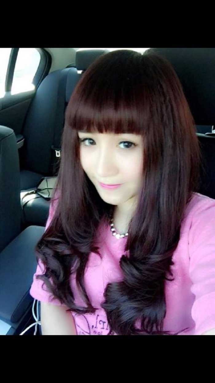 Nâng mũi bọc sụn